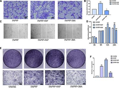 Platelet-Rich Plasma Induces Autophagy and Promotes Regeneration in Human Dental Pulp Cells